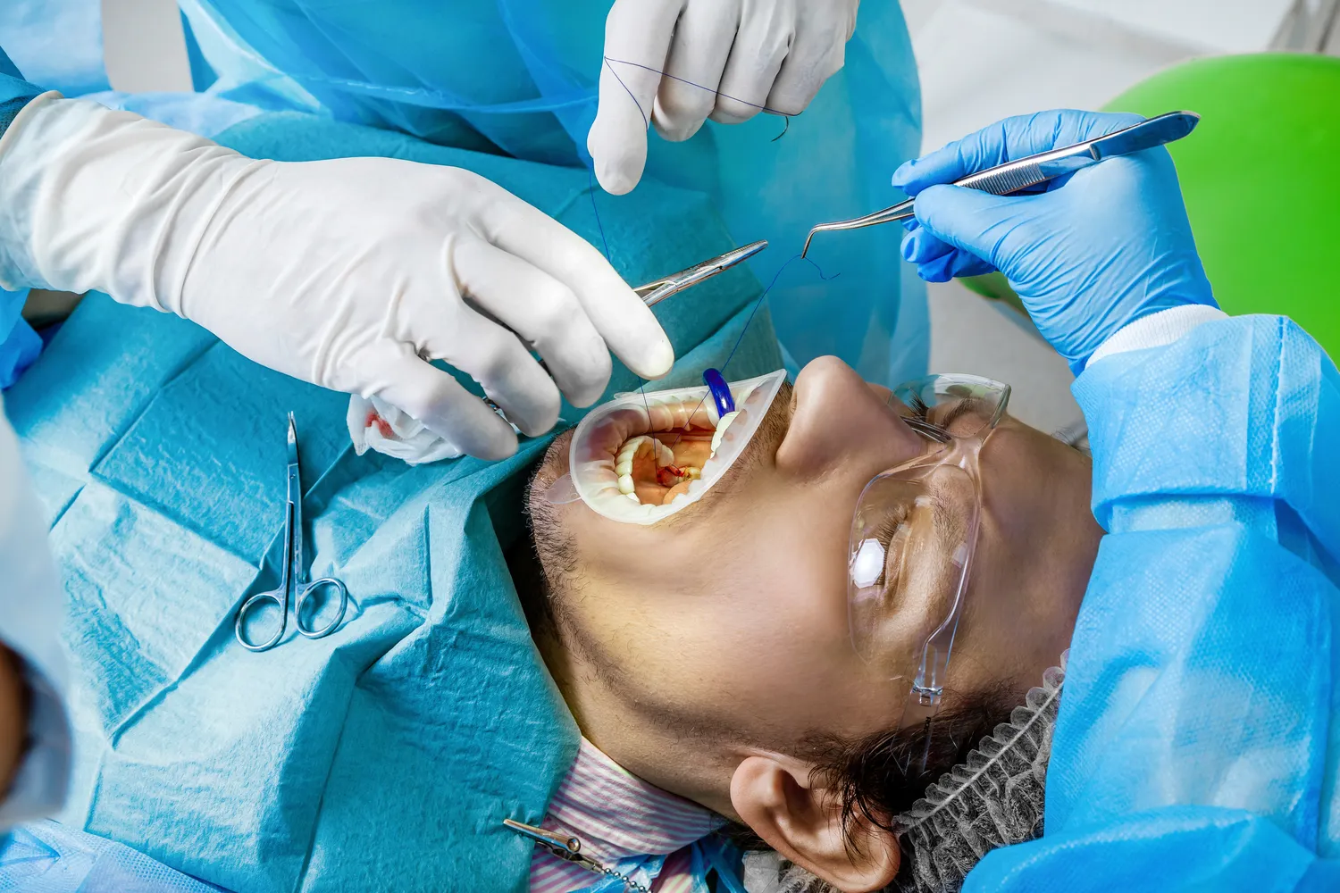 Jak długo jest ważna e-recepta na antykoncepcje?