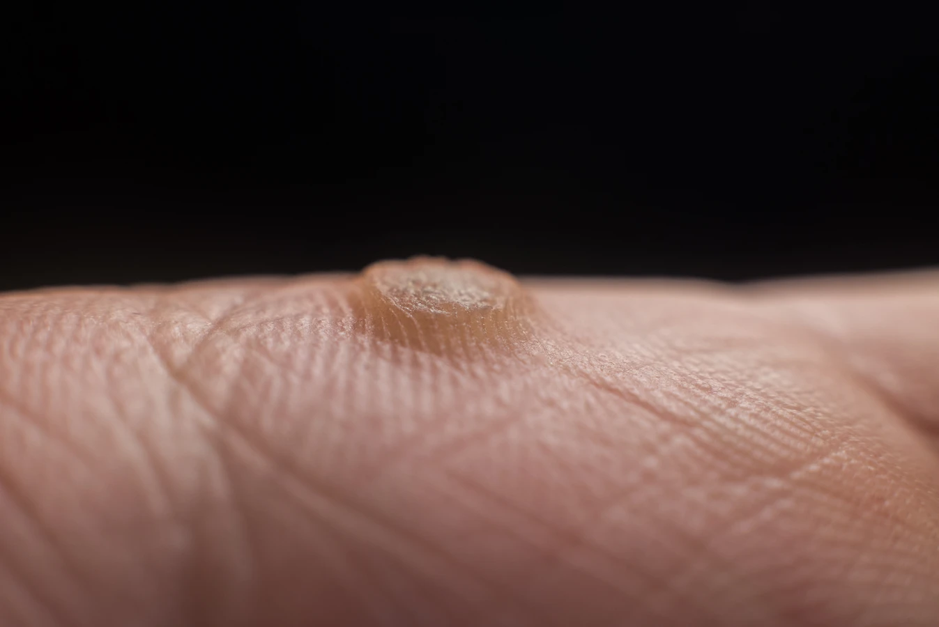 Podologia - zdrowe i ładne stopy