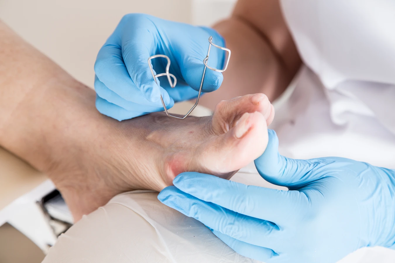 Przygotuj swoje stopy na lato - podologiczne ABC